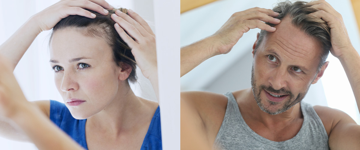 Hair loss treatment for men and women in surrey