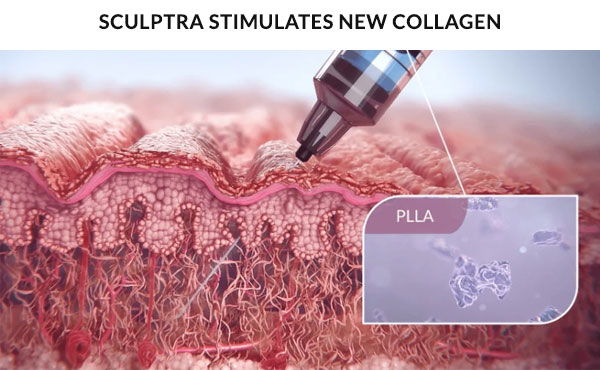 adipocyte, elastin and collagen stimulation in the skin