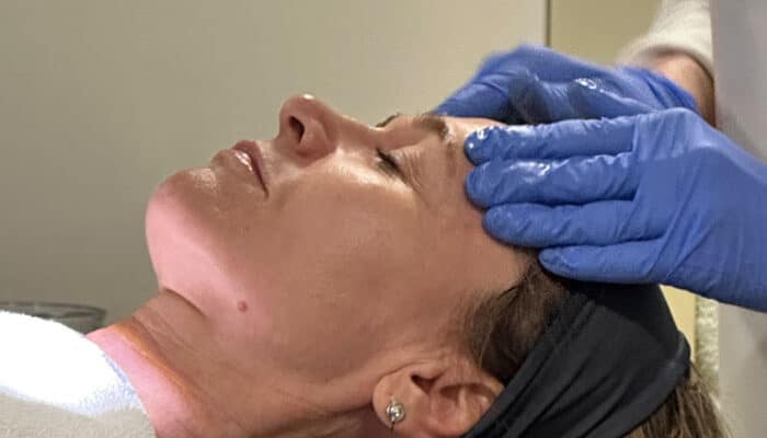 Exosomes liquid laser skin regeneration