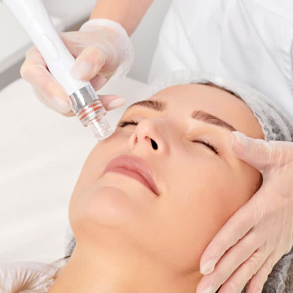 Exosomes Dermalux facial, Surrey